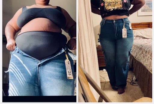 Desty’s identity-protected side-by-side progress photograph, earlier view on the left and current view on the right