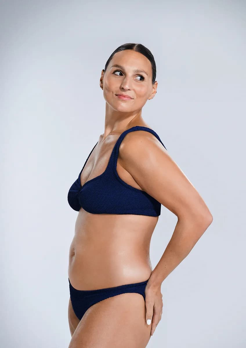 Before CoolSculpting photograph of Donna, 29, actual patient