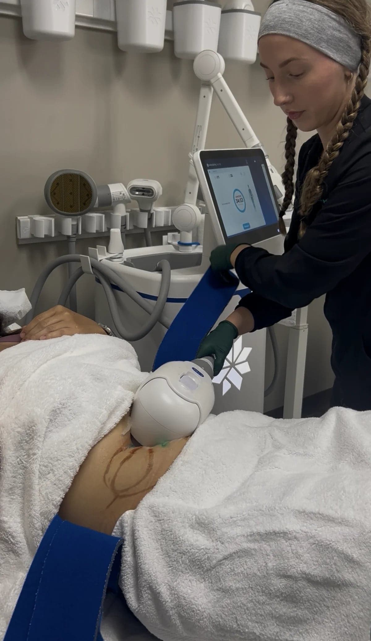 CoolSculpting Elite treatment in progress at WellForm MD